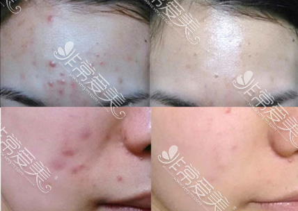韩国明星皮肤管理、研发护肤品的林二石皮肤科敢信吗