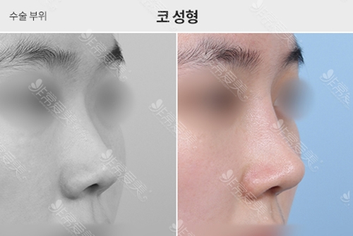 韩国做鼻子做得好的整形医院有哪几家