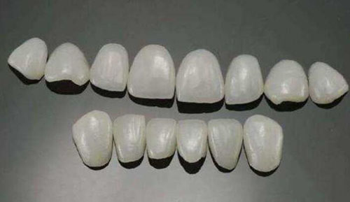 全瓷牙贴面优点有哪些