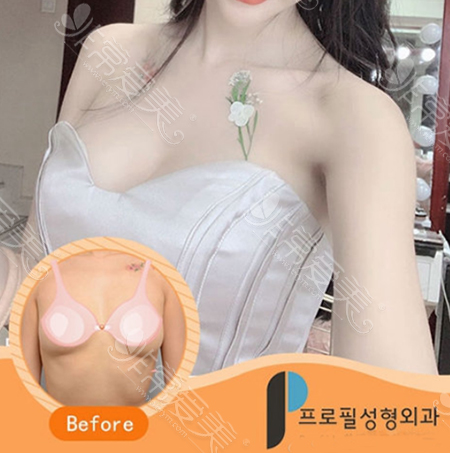 韩国普罗菲耳猫系少女胸