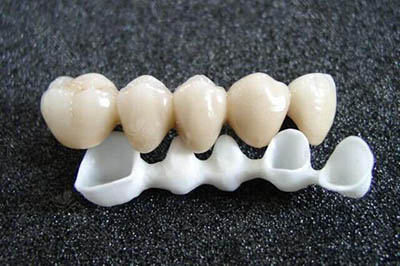 二氧化皓全瓷牙做牙齿修复好吗