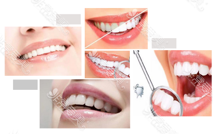 全瓷牙有几种材质扫盲贴！韩国日本都常用树脂还是其他？