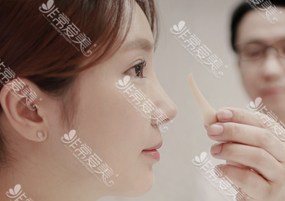 韩国olive整形外科4D隆鼻技术
