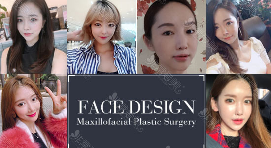 韩国创造美面部轮廓