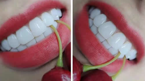 牙齿对人体的重要性
