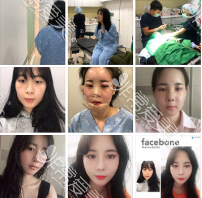 脸本脸骨整形外科在韩国首尔开业几年了？口碑好吗？