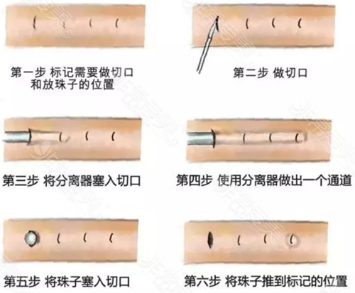 入珠视频真实照片图片