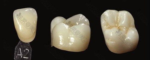 二氧化锆和水晶锆牙的区别在哪