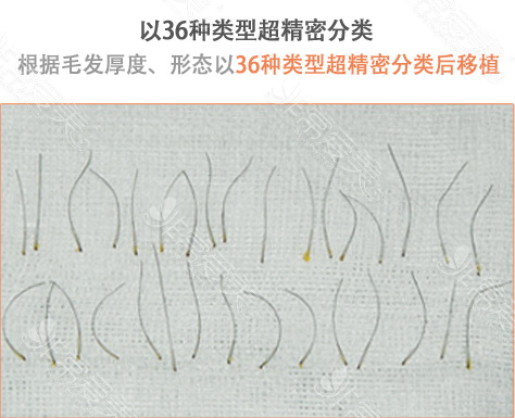 韩国多娜整形外科36种精密分类毛发