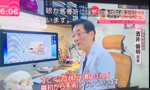 去日本割双眼皮多少钱?日本割双眼皮医院排名榜及价格揭秘!