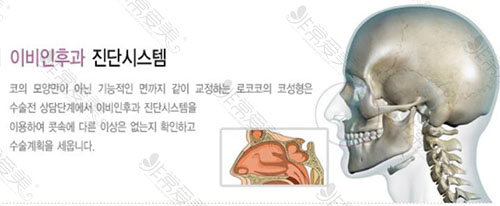 韩国rococo医院鼻整形示意图