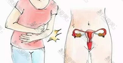 怎样检测自己子宫下垂？常见子宫下垂有什么症状如何修复