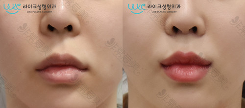 韩国来客整形外科优秀的唇整形院长叫什么名字？什么背景?