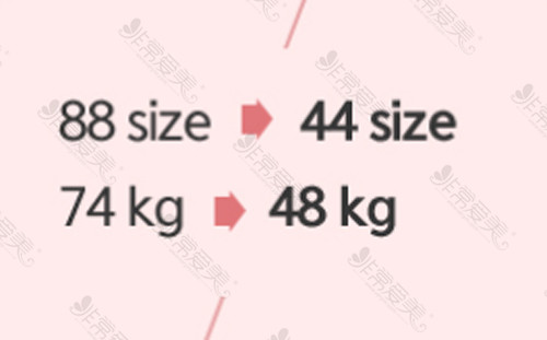 140斤做完全身抽脂能瘦多少