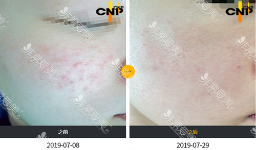 韩国CNP整形皮肤科出名吗