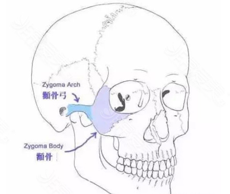 朴兴植做颧骨好吗 听说韩国医生手法和国内不同差异在哪？