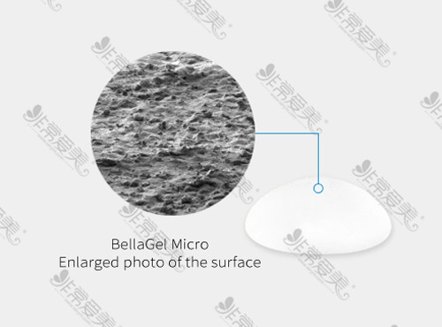 贝拉假体表面材质示意图