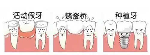 牙齿缺失该怎么修复