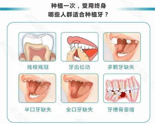 目前十堰镶牙齿一颗多少钱？镶什么材料比较好