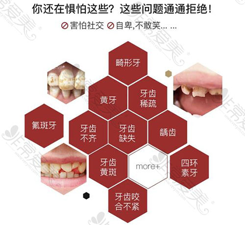 全瓷牙能改善哪些牙齿形态