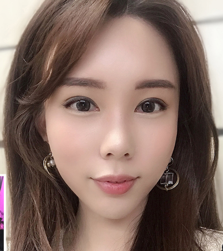1mm全脸整形效果图 1mm全脸整形效果图
