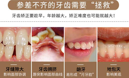 贵州哪里做矫正牙齿较好,5千正畸和3万有什么区别?