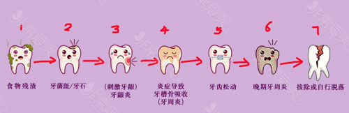 牙齿治疗的必要性图解