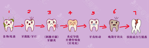 不可错过的六盘水牙科收费标准,你有什么理由不保存?