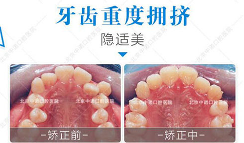 北京十大口腔医院名单公布，排名前五诊疗正规有保障！