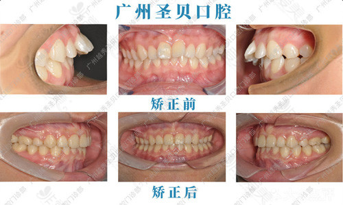 广州牙科医院前十排名公布,这十大私立口腔医院实力杠杠的!