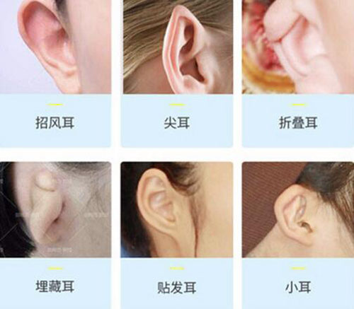 上海九慕医疗美容耳整形照片