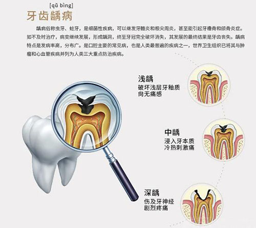 苏州看牙价格是多少?公布整牙价格表揭秘真实手术费用!