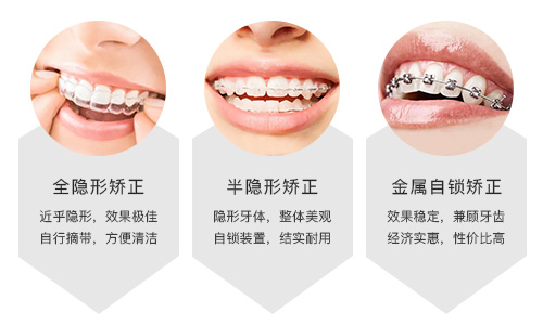 分享我在重庆韩佳牙博士做隐适美牙齿矫正的经历和价格