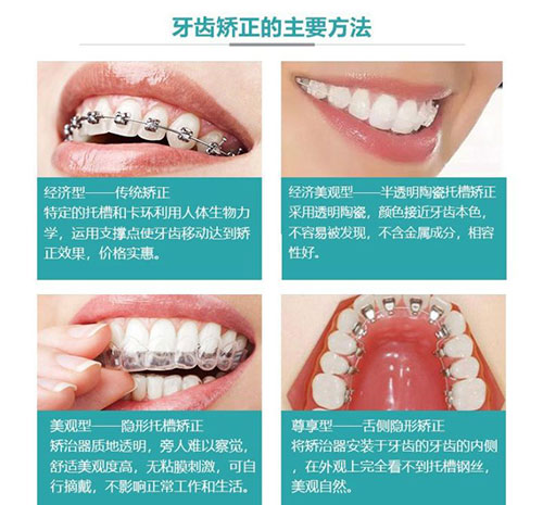 深圳诺德齿科口腔连锁牙齿矫正方法