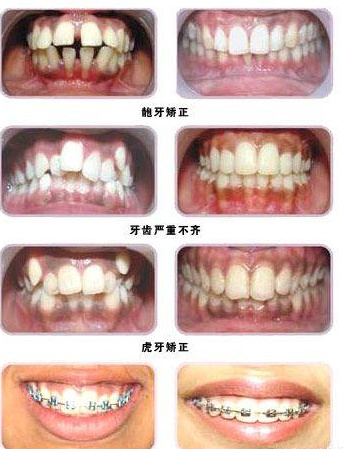 宁波做牙齿正畸比较好的医生