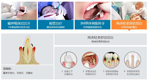 海濤口腔牙齒治療項(xiàng)目