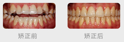盘点南京好的牙齿正畸医院 内含牙齿矫正价格表