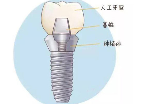 保定看牙去哪个医院好，合众口腔口碑如何，附收费价目表