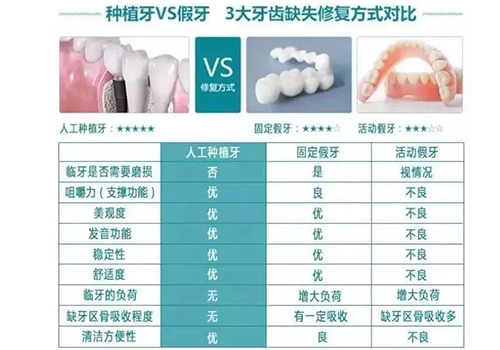 缺失牙修复体对比表格