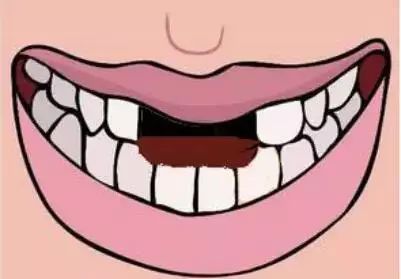 牙齿断裂只剩一点牙根