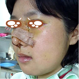广州做鼻子厉害的医生是谁