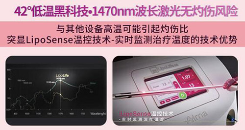 5G天使光雕吸脂有危险吗 5G天使光雕吸脂有危险吗