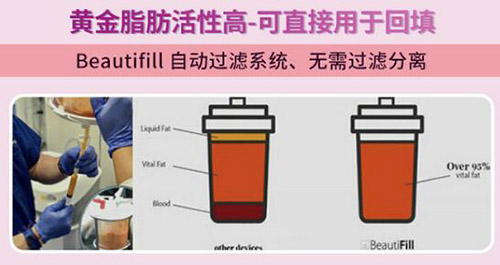 5G天使光雕吸脂优势 5G天使光雕吸脂优势