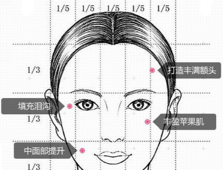 做面部脂肪填充怎样不被整形医生忽悠,汕头魏端钦值得一看