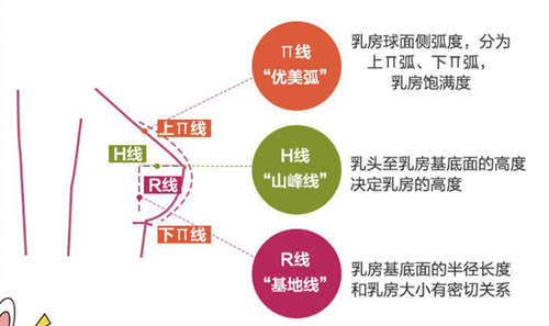 长春医美整形假体隆胸技术