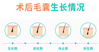 武汉五洲莱美整形外科医院医院植发技术好吗