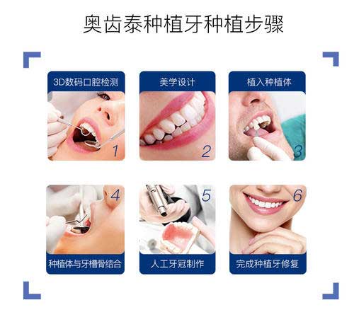 韩国奥齿泰和登腾种植牙有啥区别 韩系种植体怎么都便宜