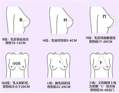 重庆光博士整形医院隆胸术法