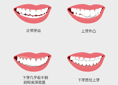 七天快速矫正靠谱吗