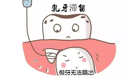 乳牙滞留而恒牙无法萌出需要拔掉乳牙